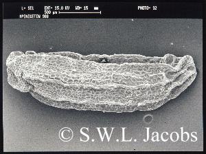 rastereletronenmikroskopische Aufnahme des Samens