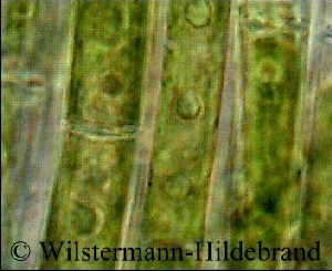 Fadenalgen unter dem Mikroskop