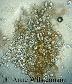 Bakterienschleim unter dem Mikroskop